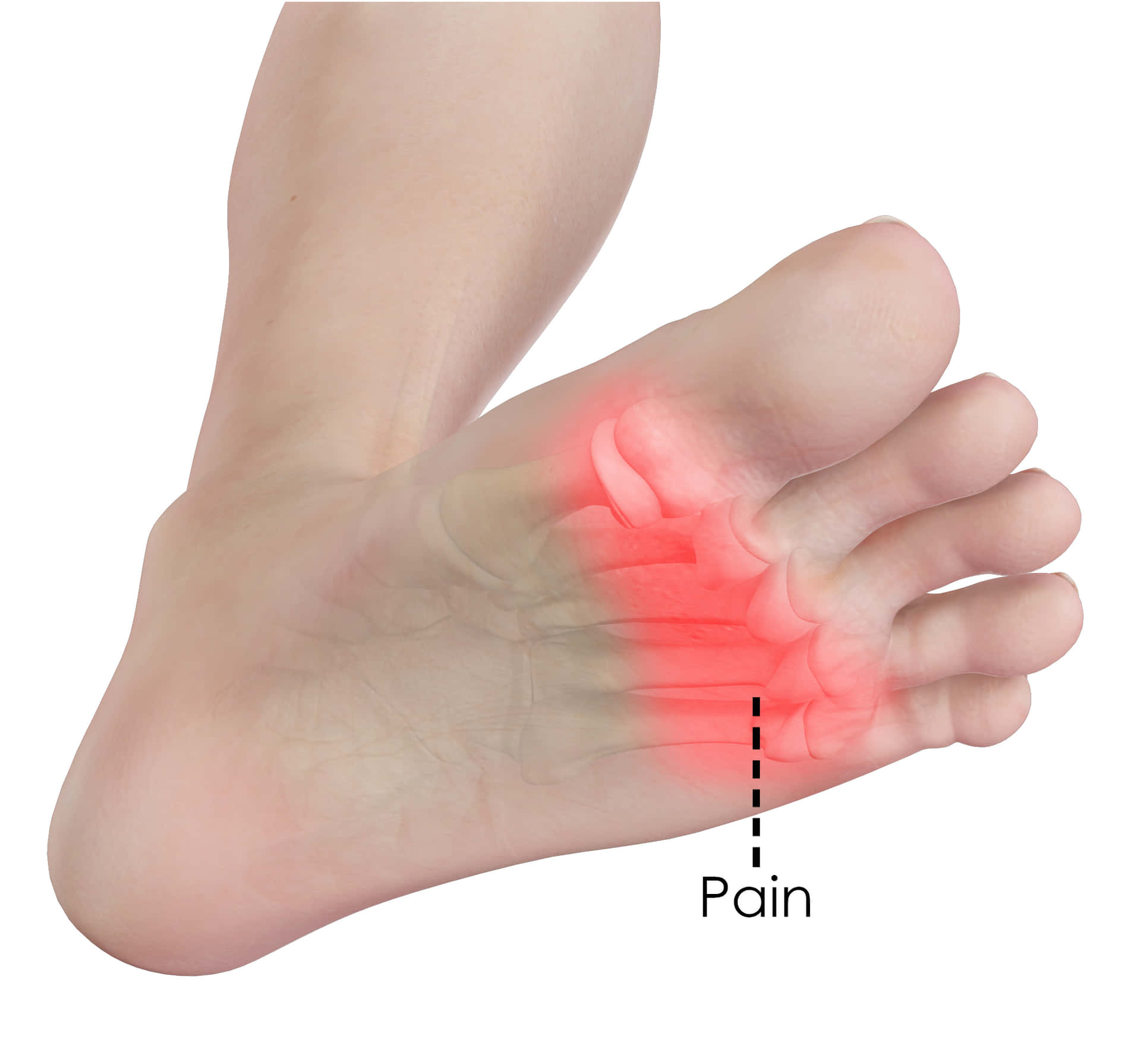 Digital Foot In Pain Picture