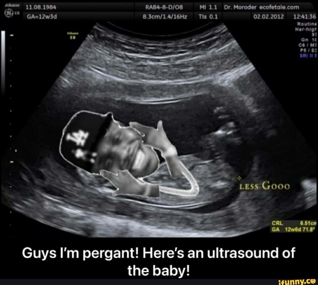 Funny Ultrasound Meme Pictures