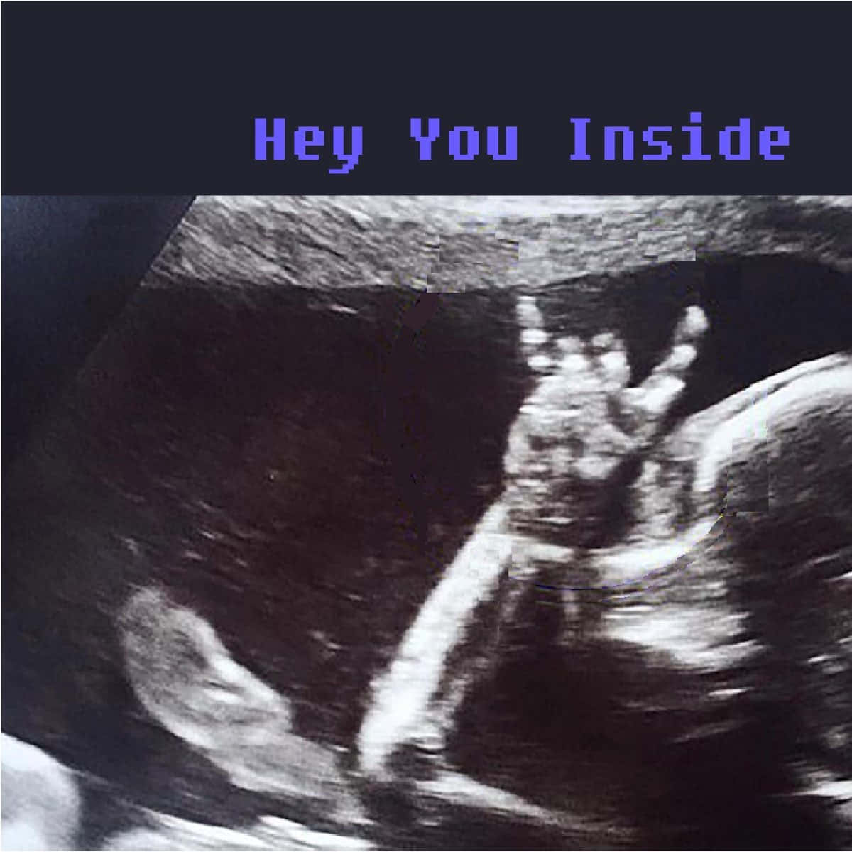 Funny Insect Ultrasound Pictures