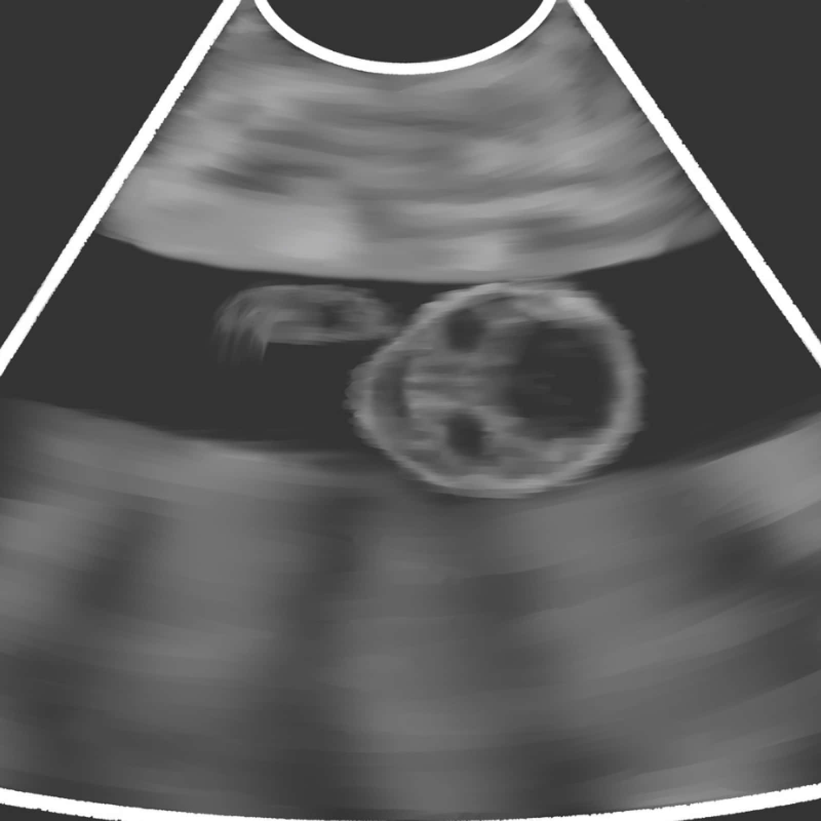 Funny Alien Ultrasound Pictures