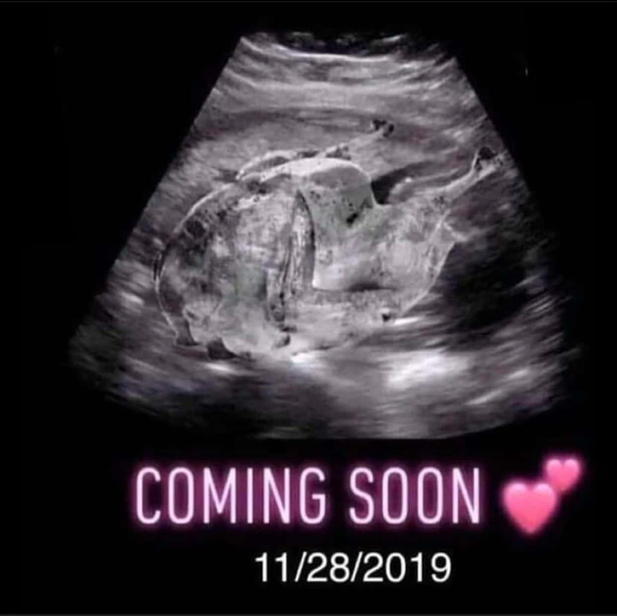 Funny Ultrasound Pictures