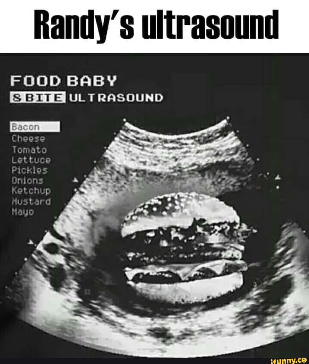 Funny Foo Ultrasound Pictures