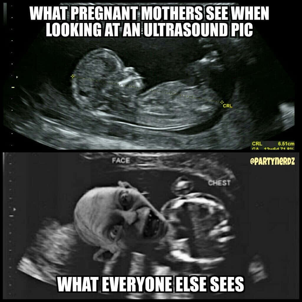 Funny Gollum Ultrasound Pictures