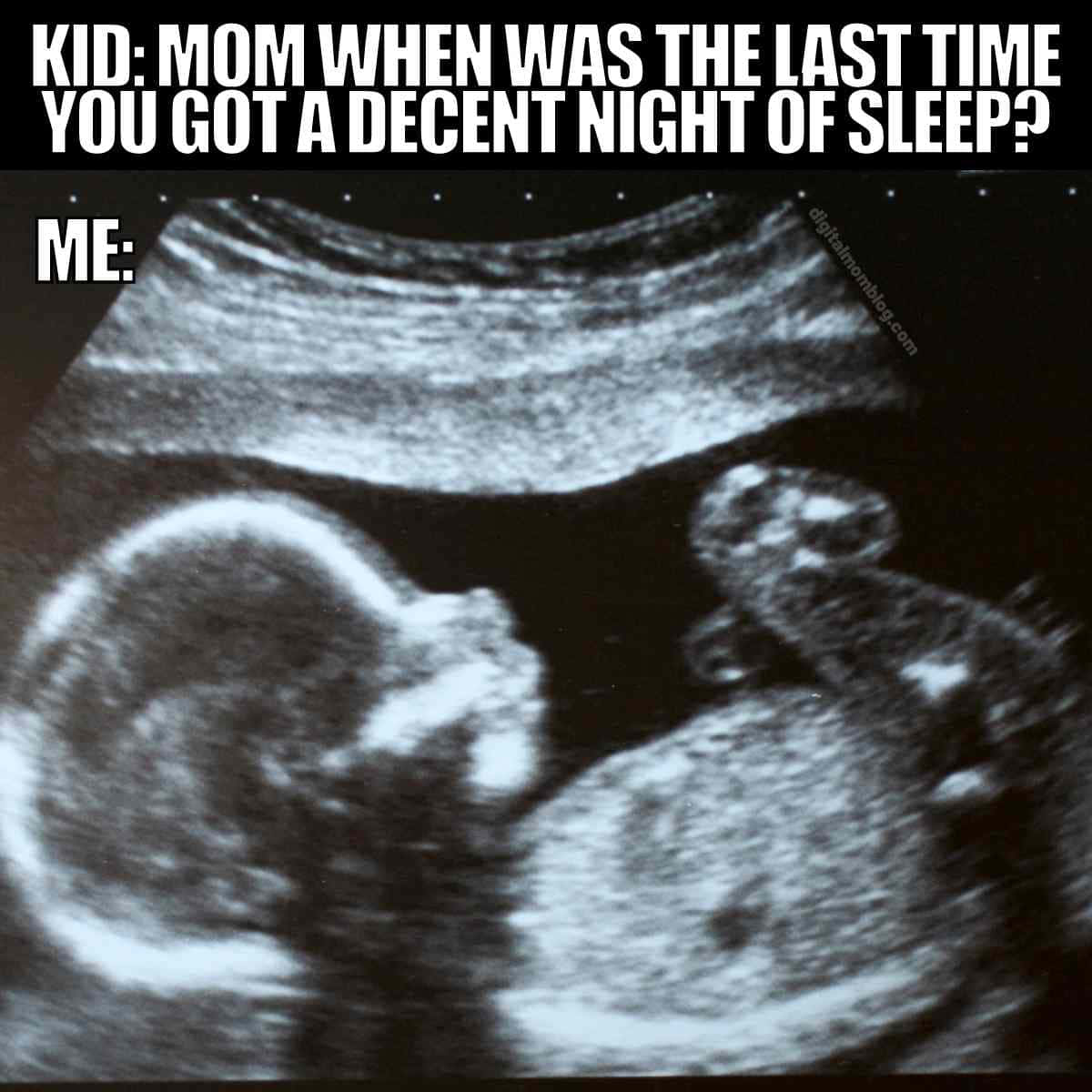 Funny Ultrasound Pictures