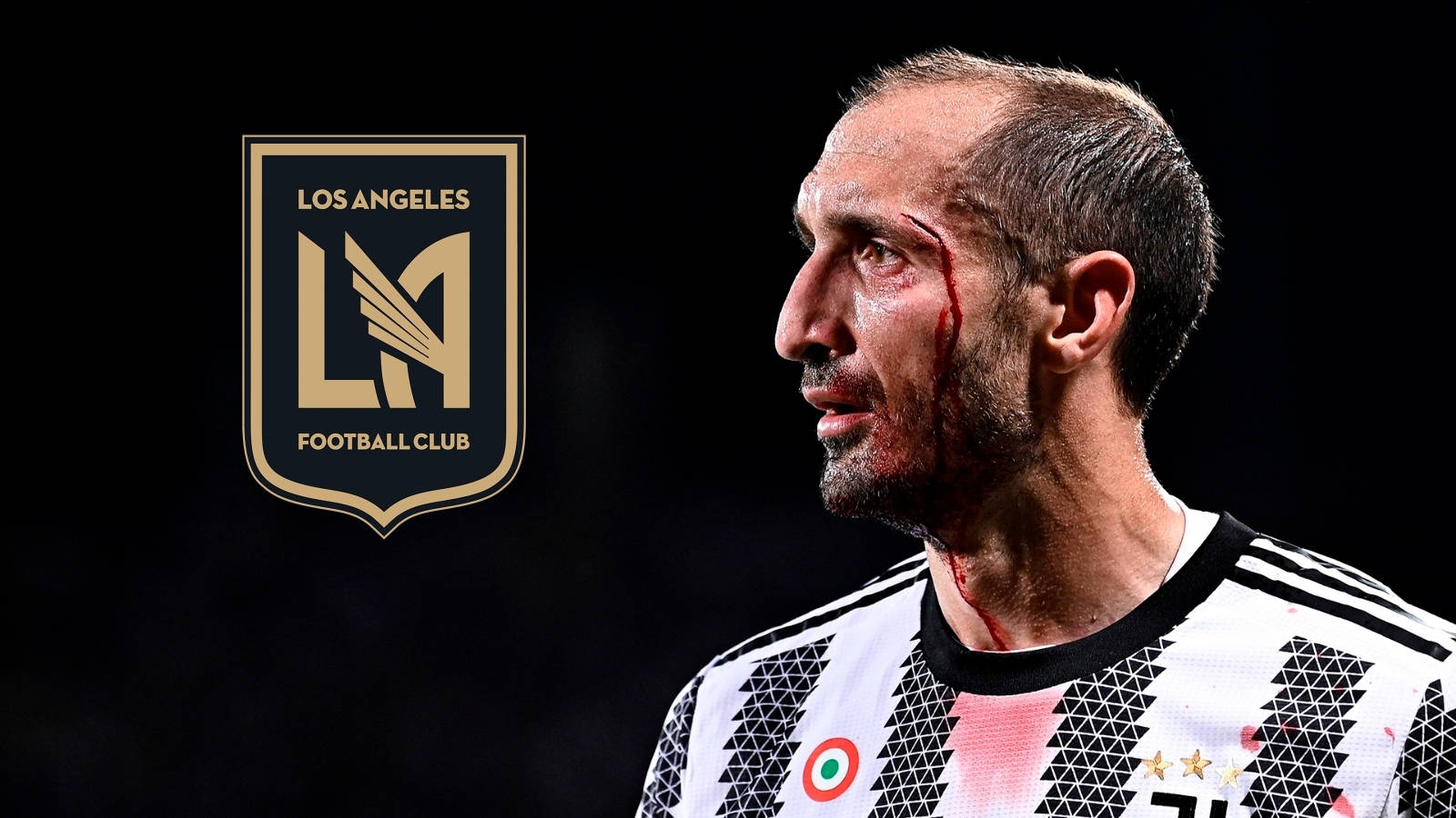 Giorgio Chiellini Los Angeles Football Bleeding Injury Wallpaper