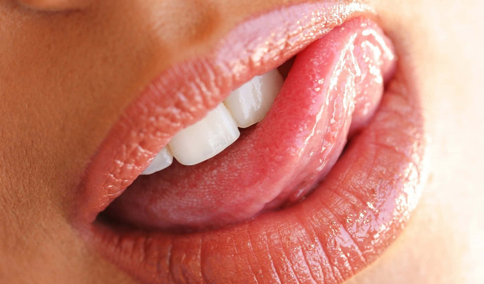 Заболевание слизистой полости рта у взрослых фото