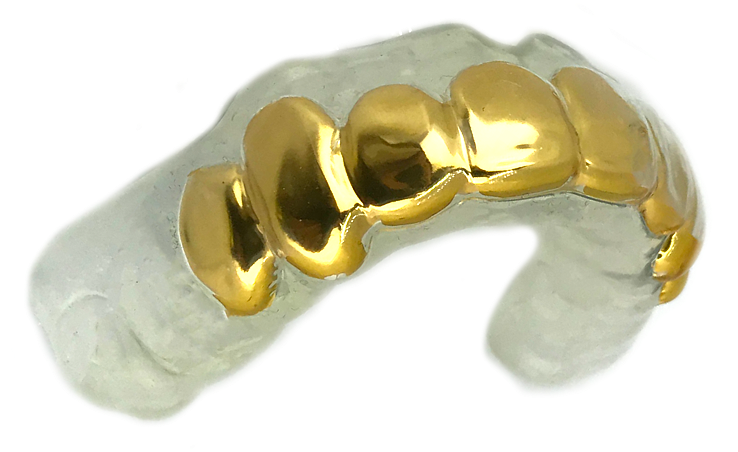 Gold Dental Crown Mold PNG