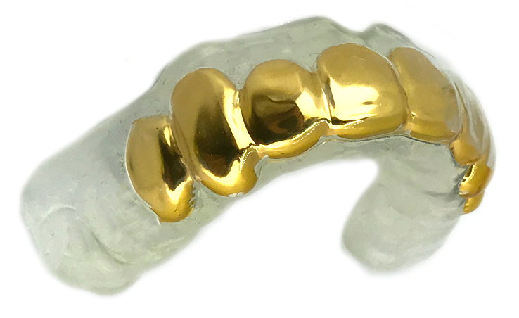 Download Gold Dental Crown Mold | Wallpapers.com