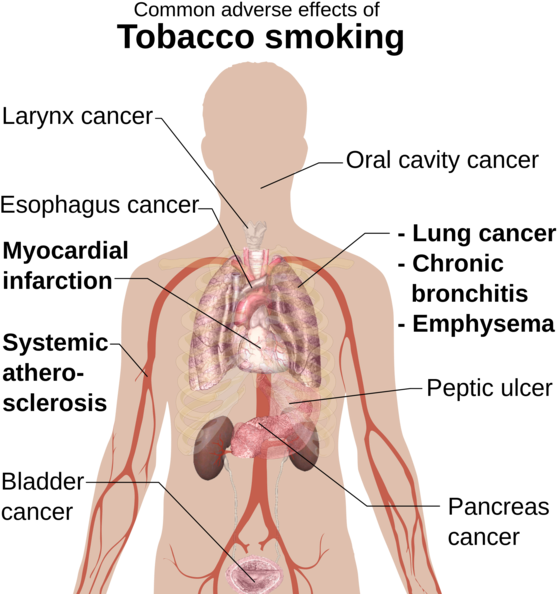 Health_ Impacts_of_ Smoking_ Illustration.png PNG