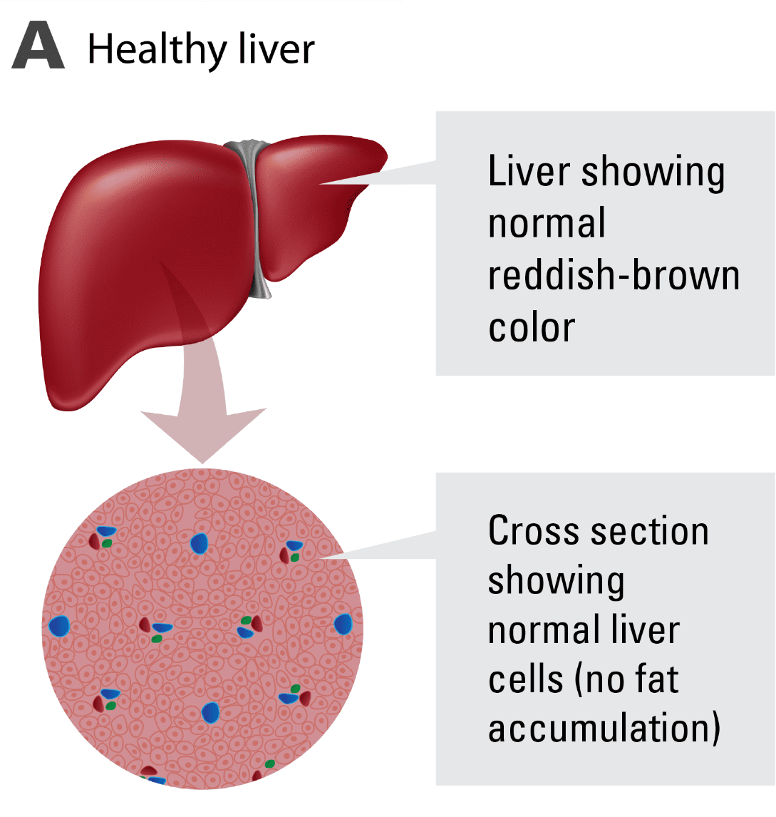 Healthy Liver Structureand Cells PNG