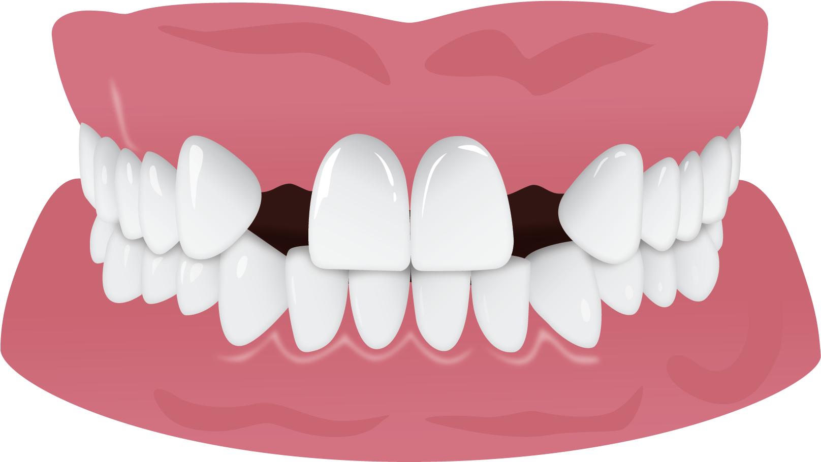 Healthy Teeth Illustration.png PNG