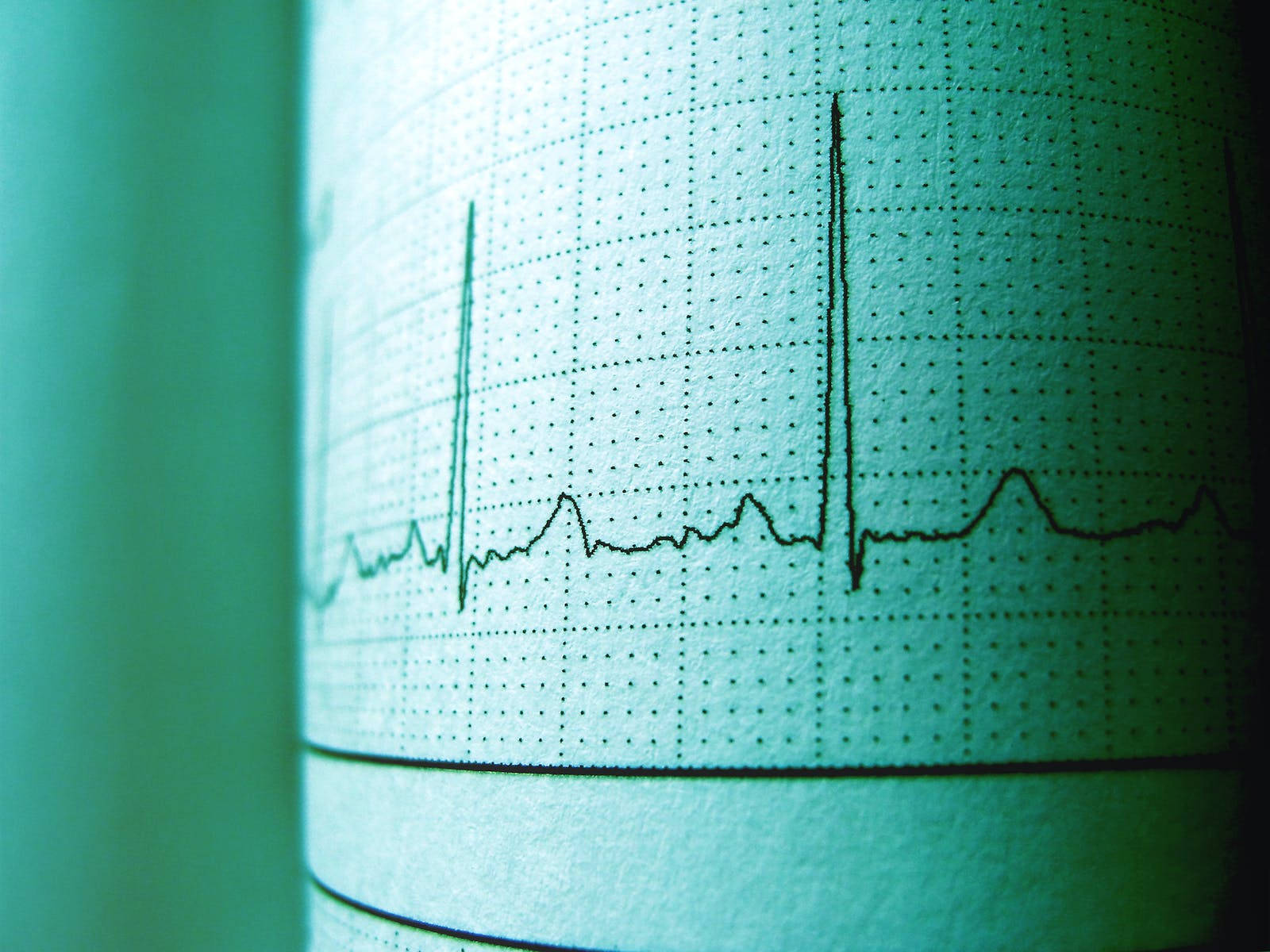 Heartbeat Cardiogram Wavelength Wallpaper
