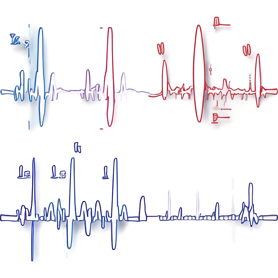 Heartbeat Ekg For Fitness Png Hda49 PNG