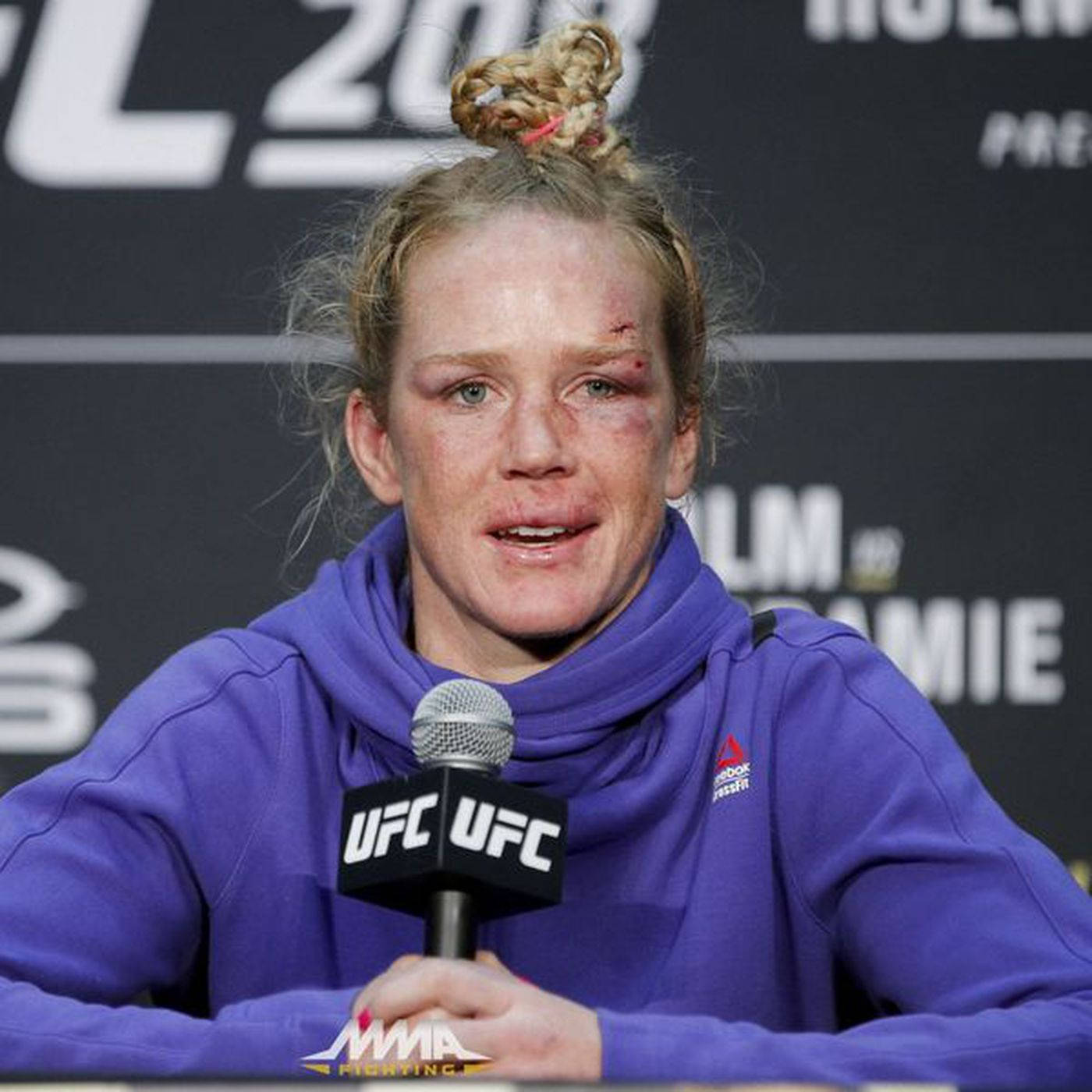 Holly Holm Bruised Face Wallpaper