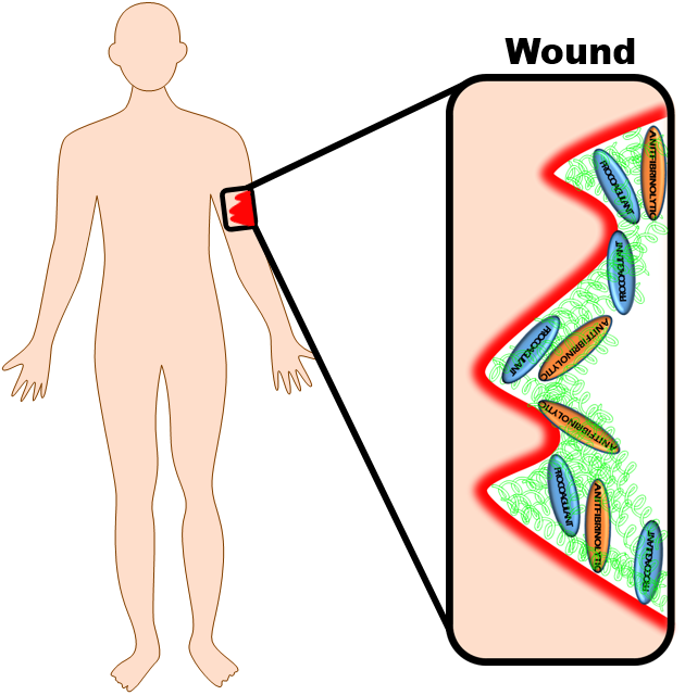 Human Anatomy Wound Diagram PNG