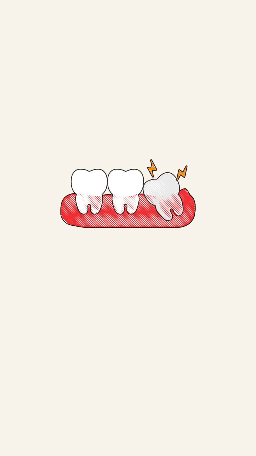 Download Impacted Wisdom Tooth Illustration Wallpaper | Wallpapers.com