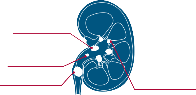 Kidney Anatomy Diagram PNG