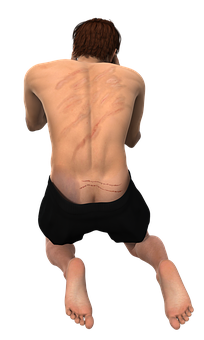 Man Kneeling Back Scars PNG