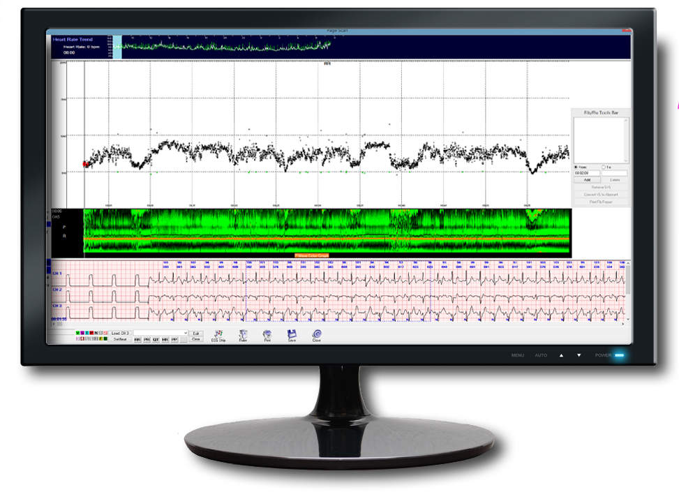 Medical Monitor Displaying Heart Rateand Sleep Data PNG