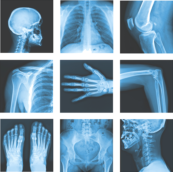 Medical_ X Ray_ Collage PNG