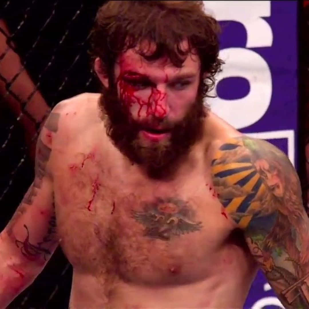 Michael Chiesa With A Bloody Face Wallpaper