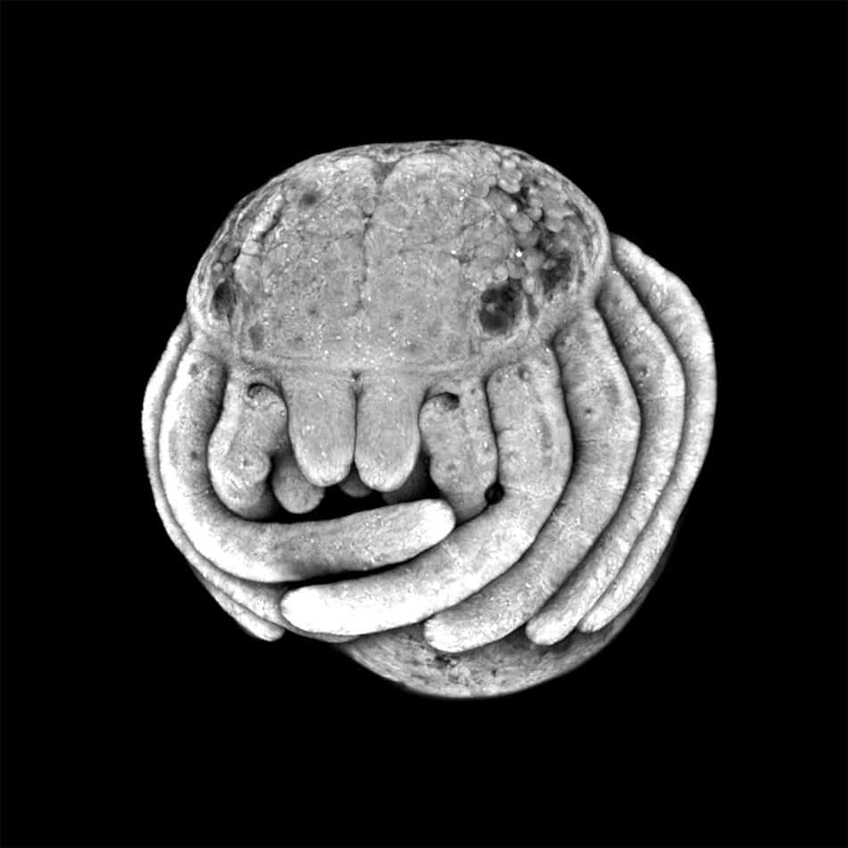 Immaginedi Un Embrione Di Ragno Microscopico.
