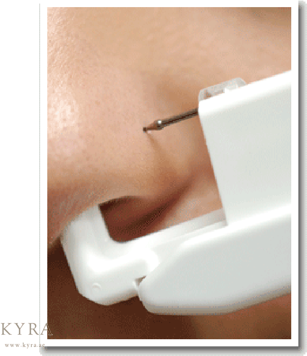 Nose Piercing Procedure Closeup PNG