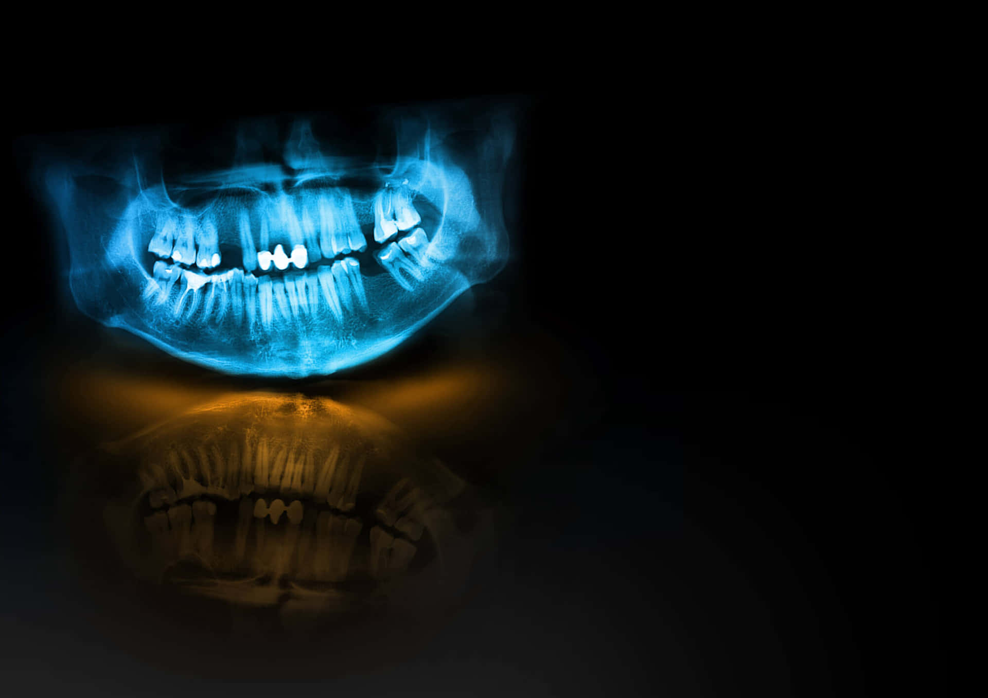 Oral Mouth X-ray Wallpaper
