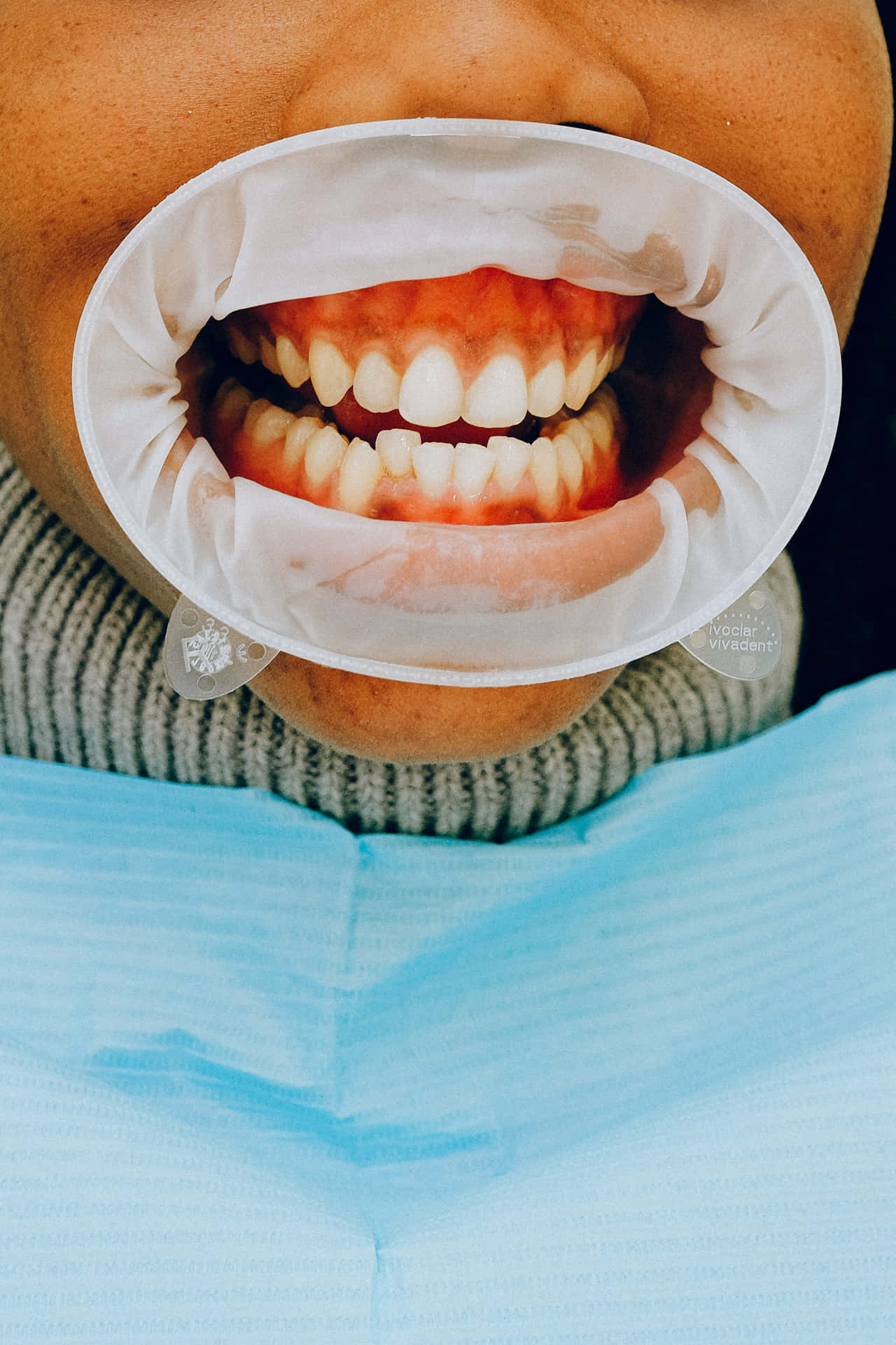 Oral Surgery Image Wallpaper