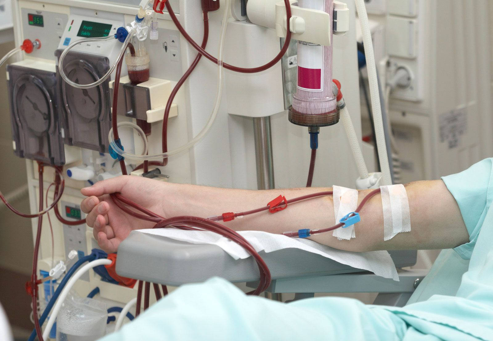 Patient During Dialysis Picture