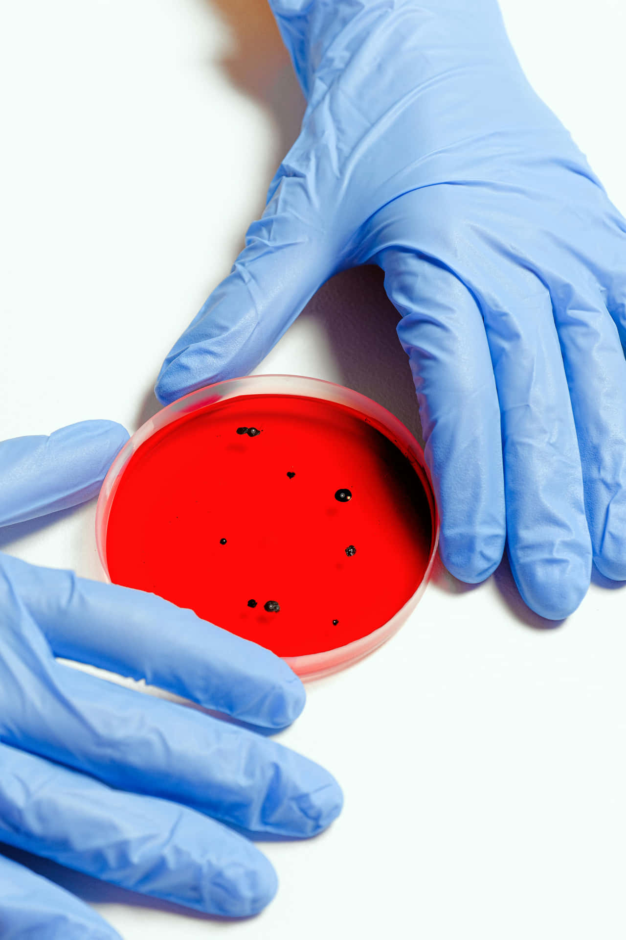 Petri Dish Bacterial Colonies Blue Gloves Wallpaper