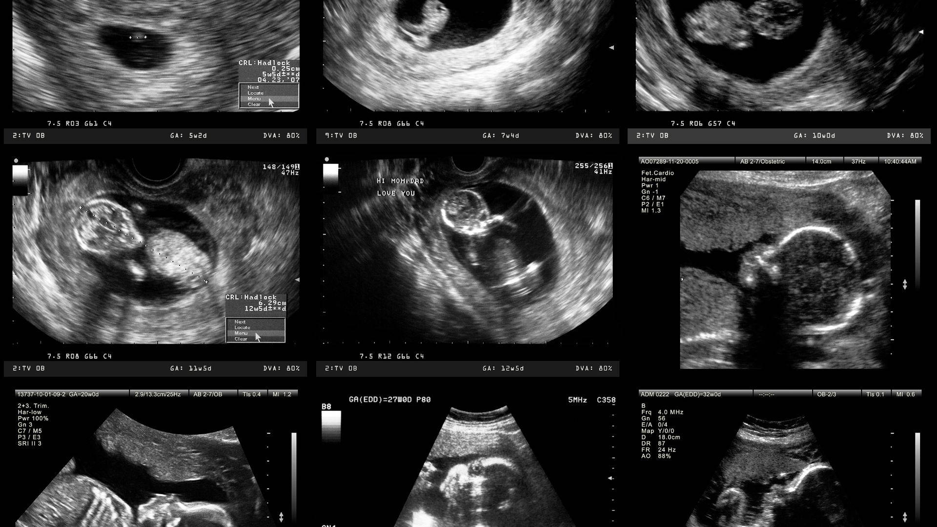Schwangerschaftsultraschallfotos Wallpaper