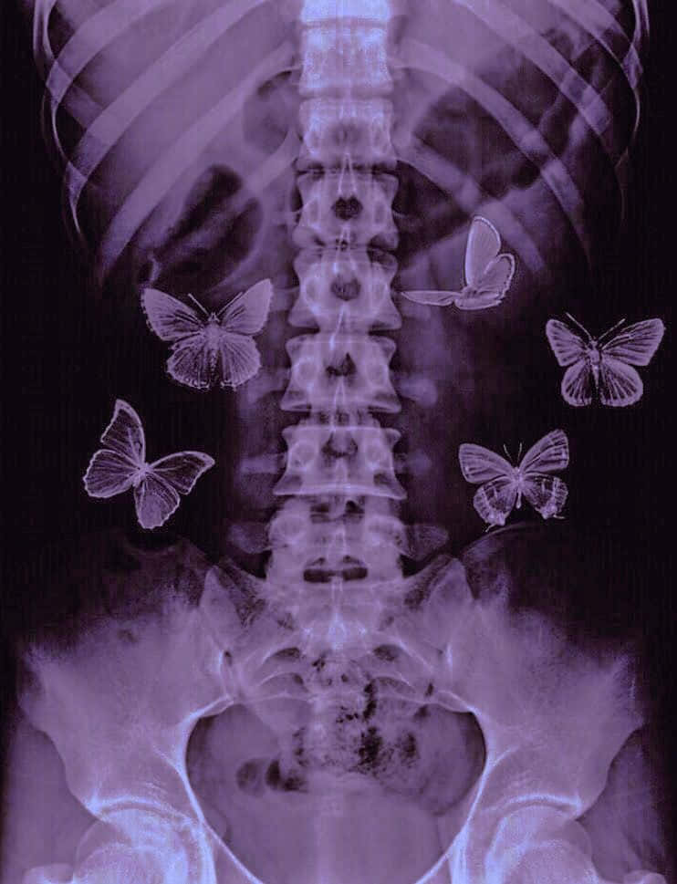 Purple Xray Butterflies Aesthetic.jpg Wallpaper