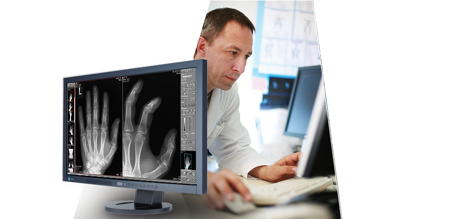 Radiologist Analyzing Hand Xray PNG