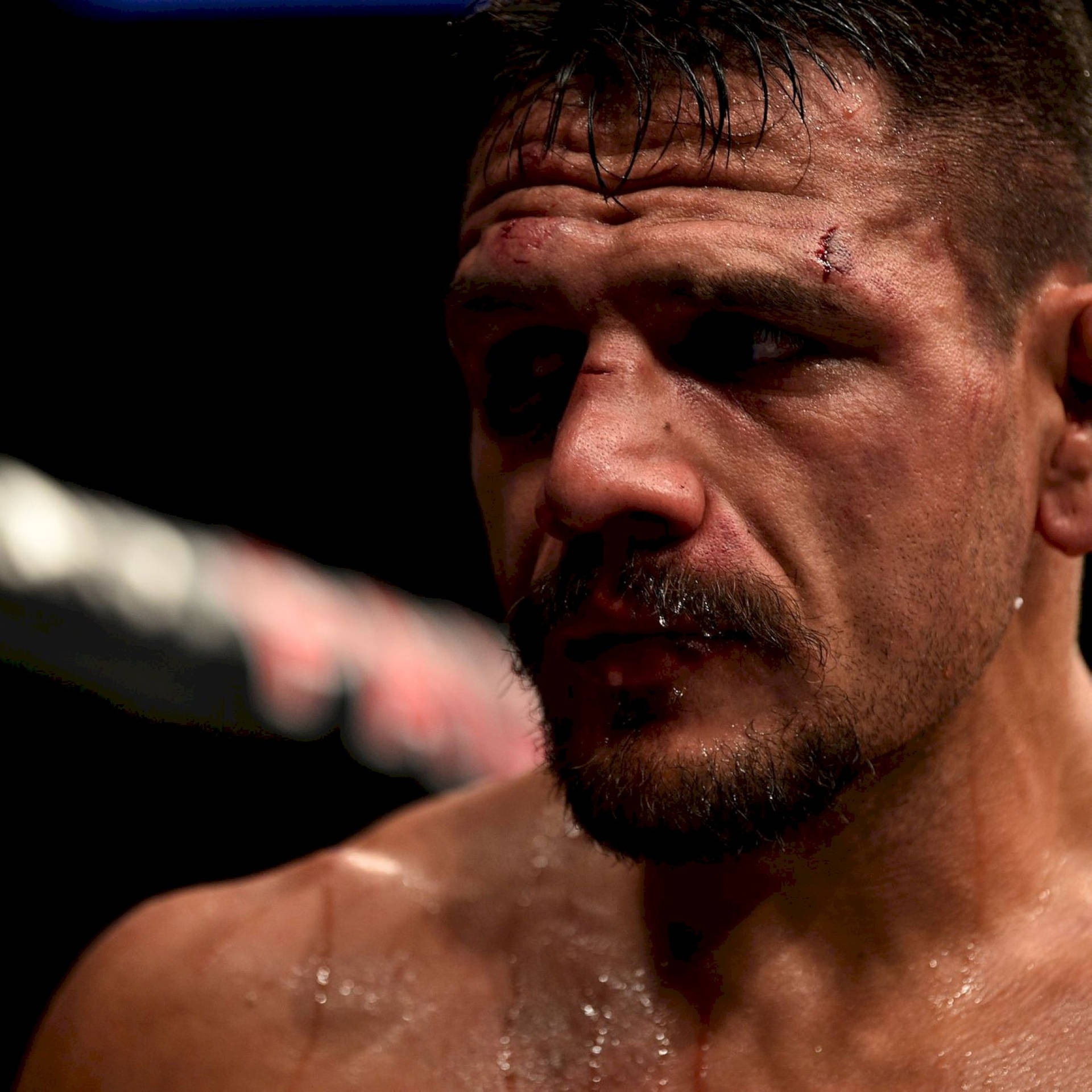 Rafael Dos Anjos With Cuts On Face Background