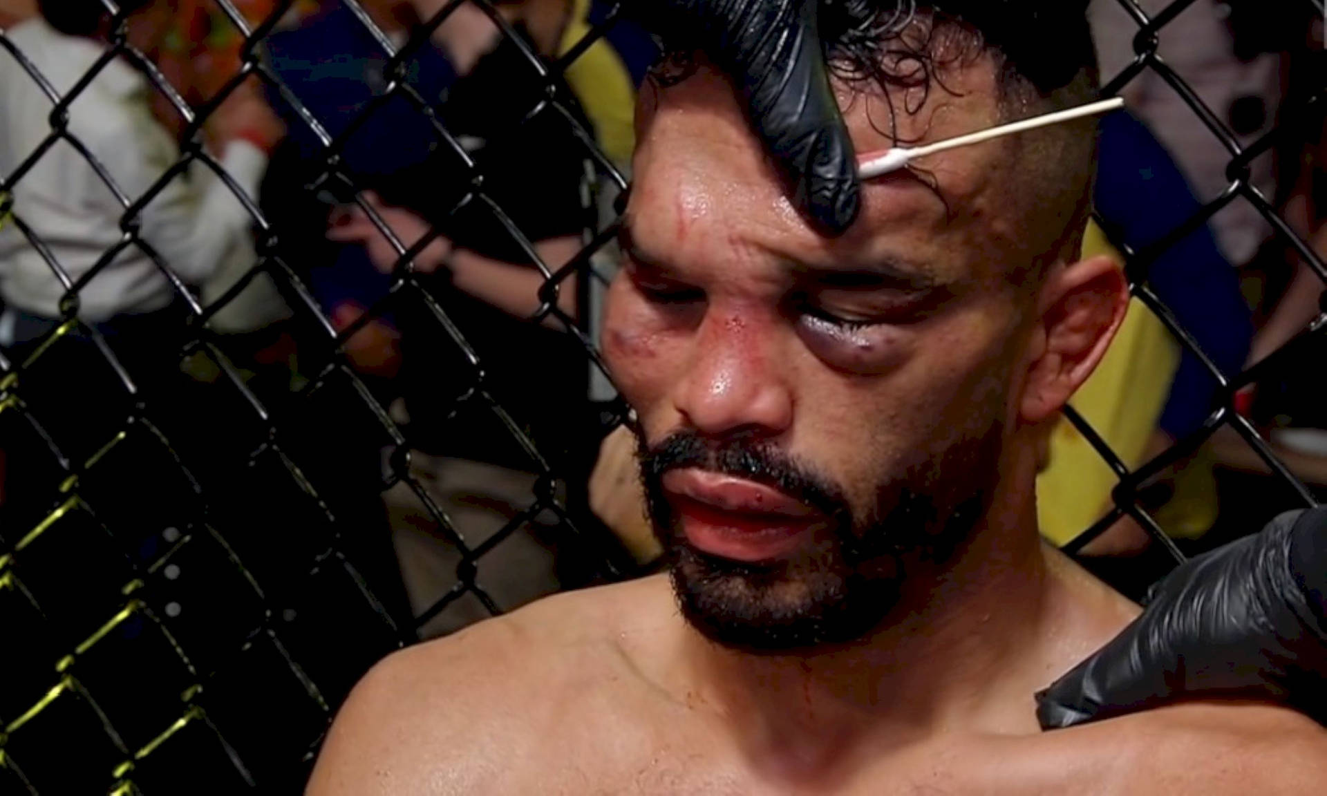 Rob Font Injured After Fight Wallpaper
