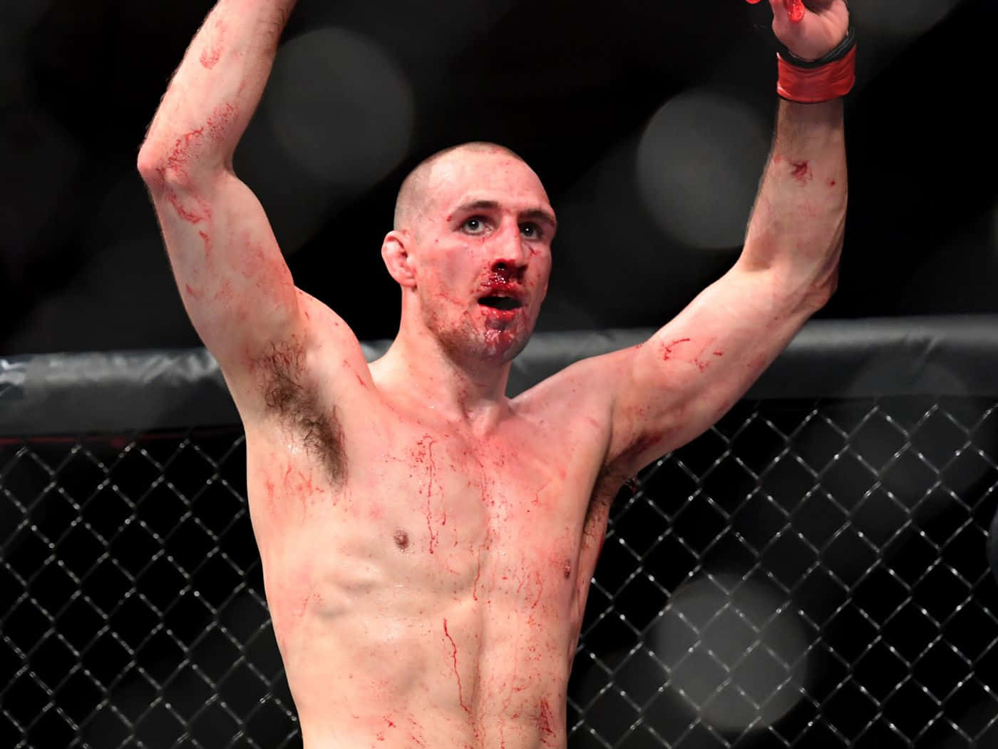 Rory MacDonald Celebrating With Bloody Face Wallpaper