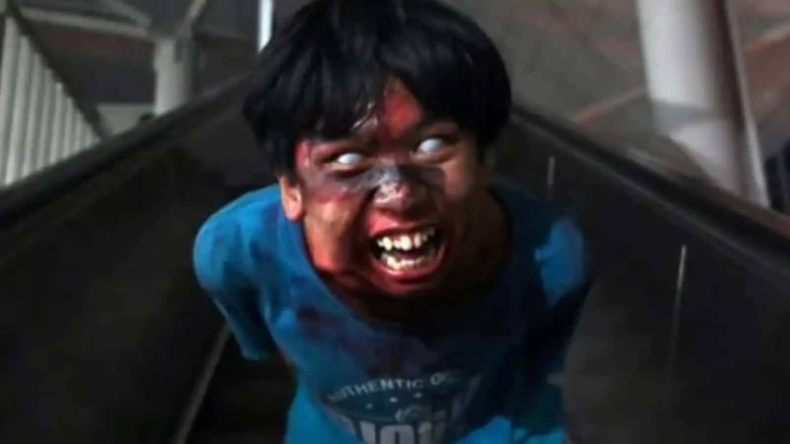 A Boy With Blood On His Face On An Escalator
