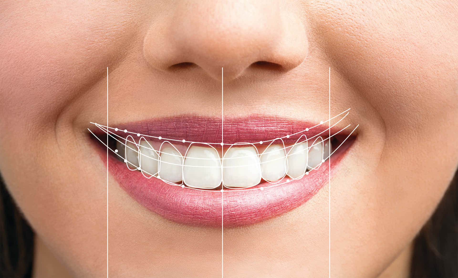 Perfect Smile Pattern Picture