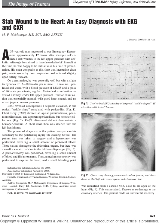 Stab Wound Diagnosiswith E K Gand C X R PNG