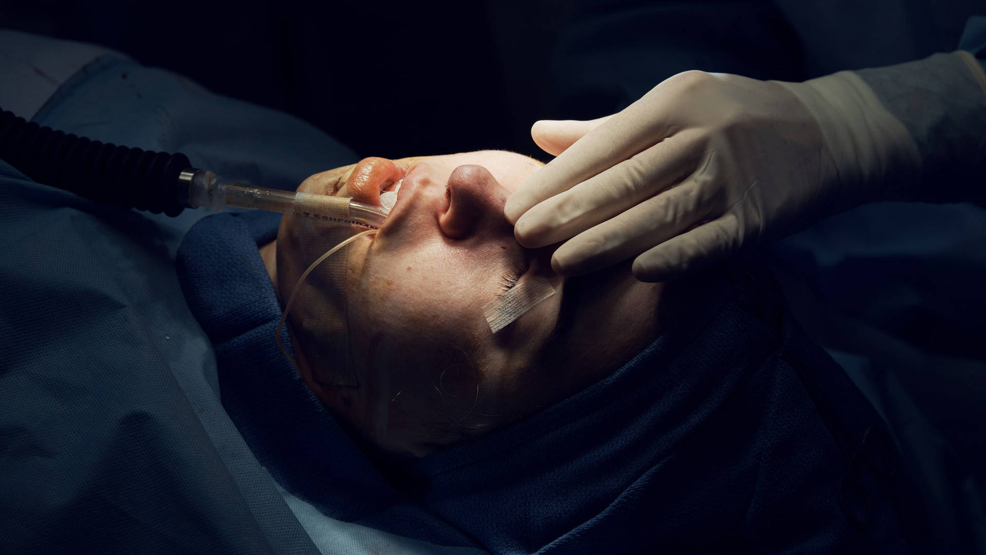 Kirurg hjælper med at sætte åndedrætsrør ind i næsekirurgi. Wallpaper