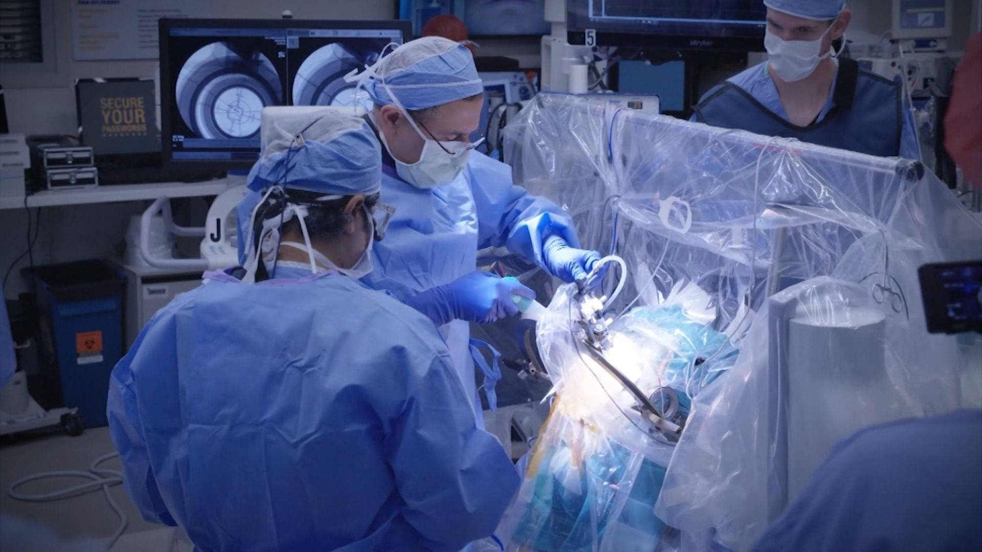 Cirujanoen Cirugía Experimental Del Cerebro Fondo de pantalla