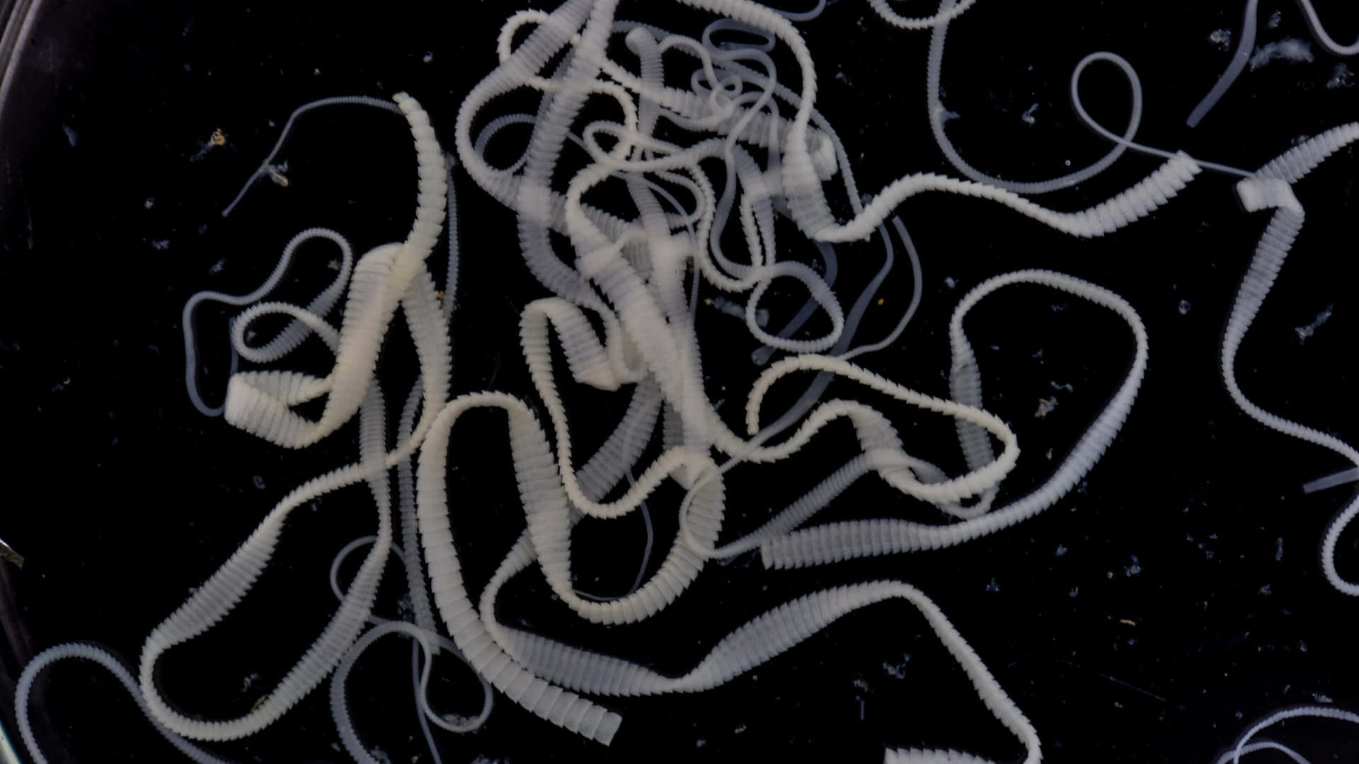 Tapeworm Infestation Dark Background Wallpaper