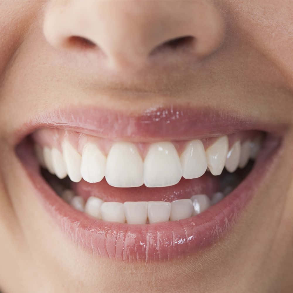 Iluminatu Sonrisa Con Blanqueamiento Dental Fondo de pantalla