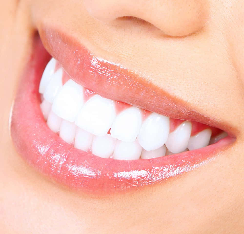 ¡obténuna Sonrisa Más Brillante Y Más Blanca Con El Blanqueamiento Dental Profesional! Fondo de pantalla