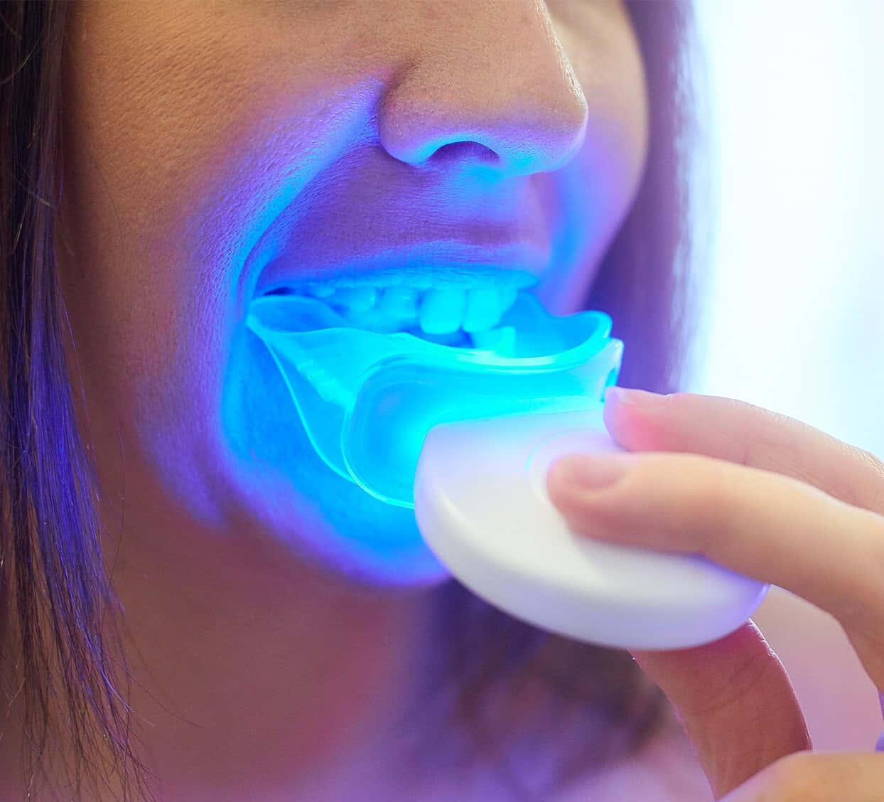 Transform Your Smile With Teeth Whitening Wallpaper