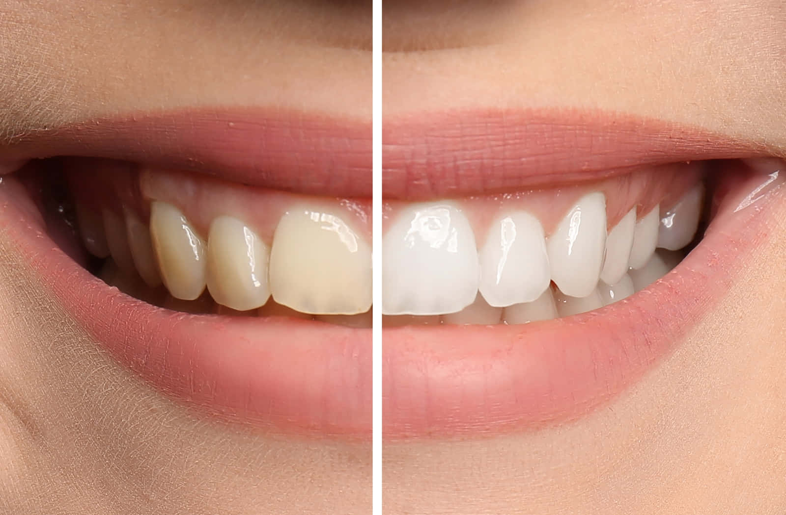 Achieving a brighter and whiter smile has never been easier Wallpaper