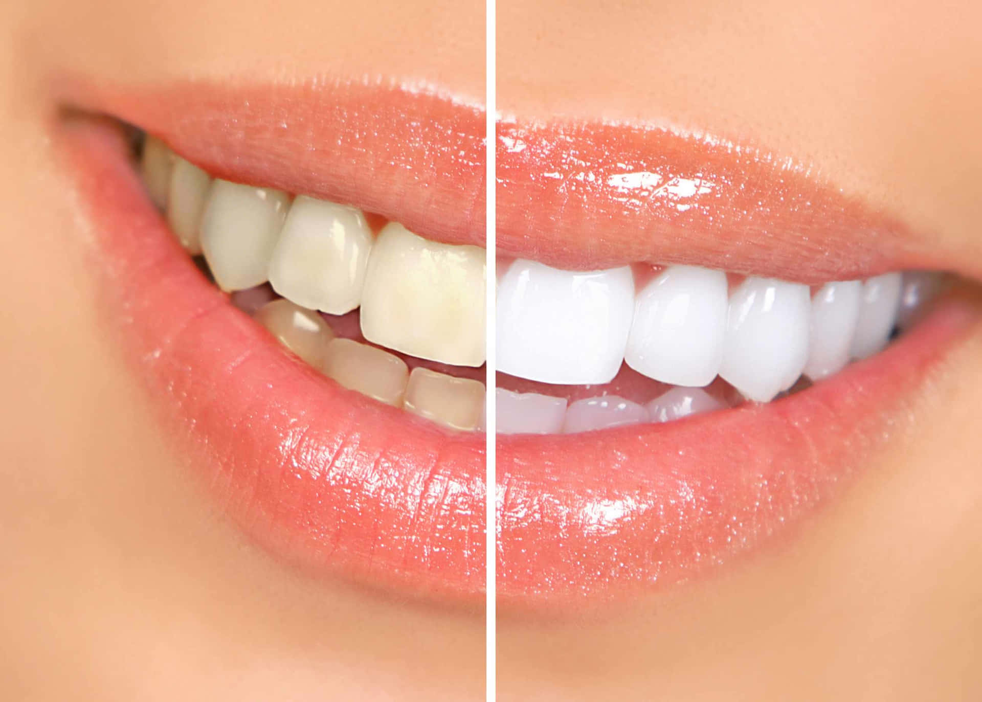 Get a pearly white smile with teeth whitening treatments! Wallpaper