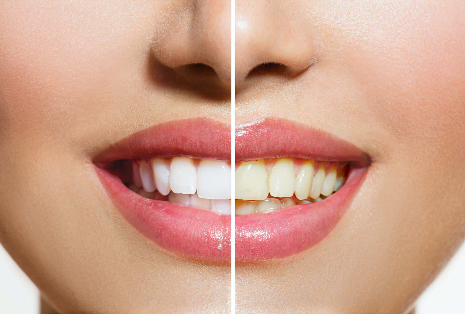 Get a whiter, brighter smile with teeth whitening! Wallpaper