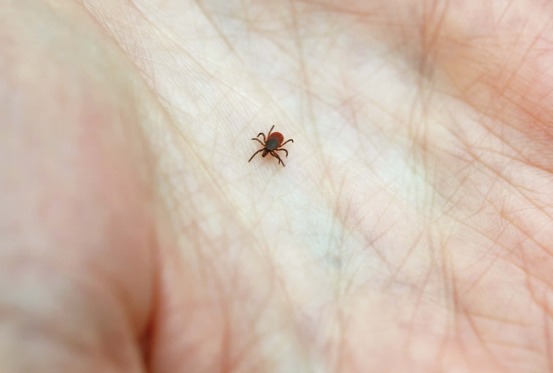 Small Tick On The Palm Pictures